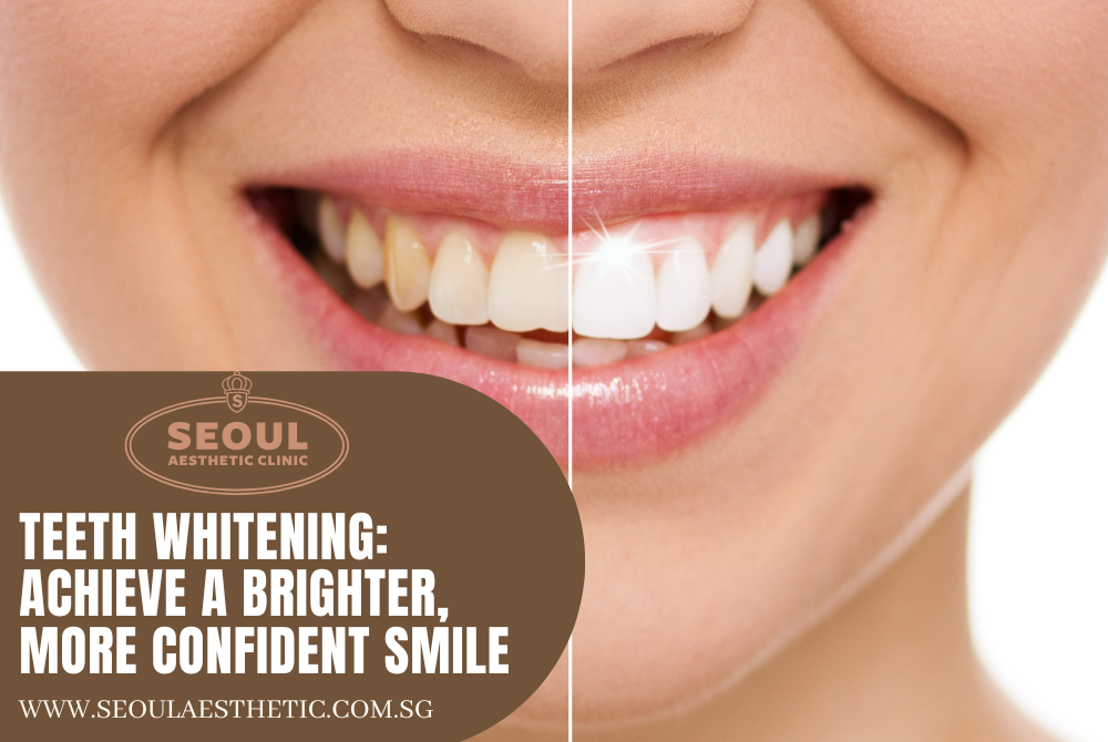 Seoul - Teeth Whitening