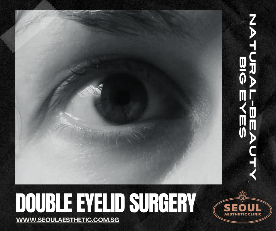 EYEBAG SURGERY EYEBAG SURGERY
