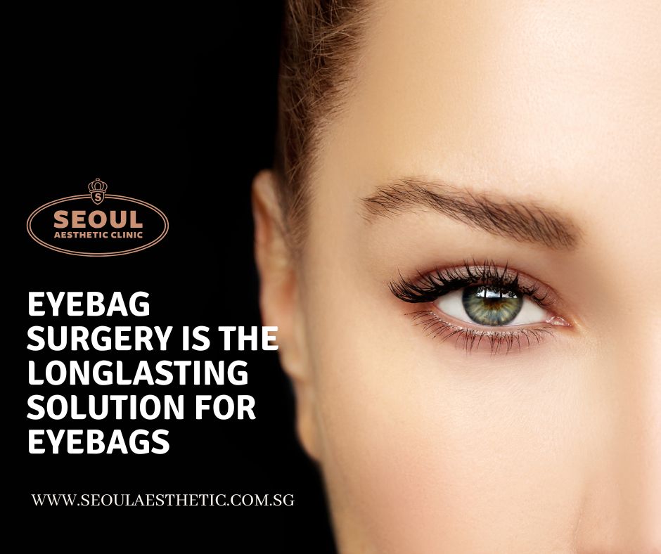 Lower blepharoplasty (EYEBAG SURGERY) is a surgery to address eyebags, excess skin, and fat in the lower eyelids.